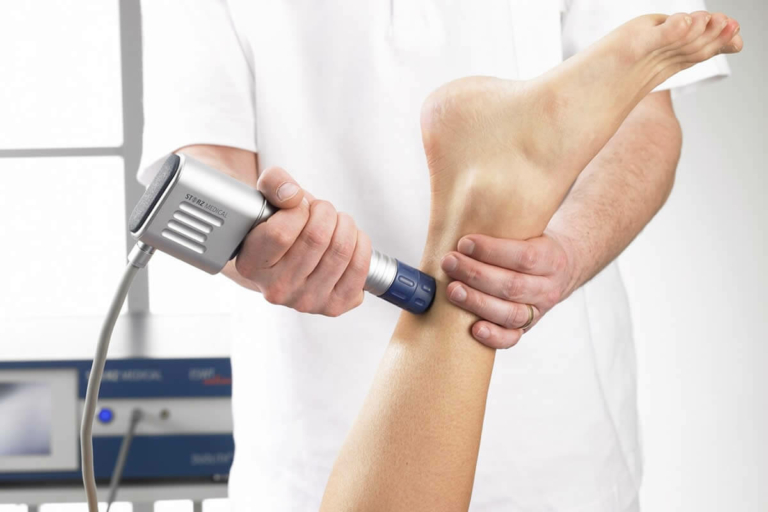 Terapija z udarnimi globinskimi valovi (ESWT)