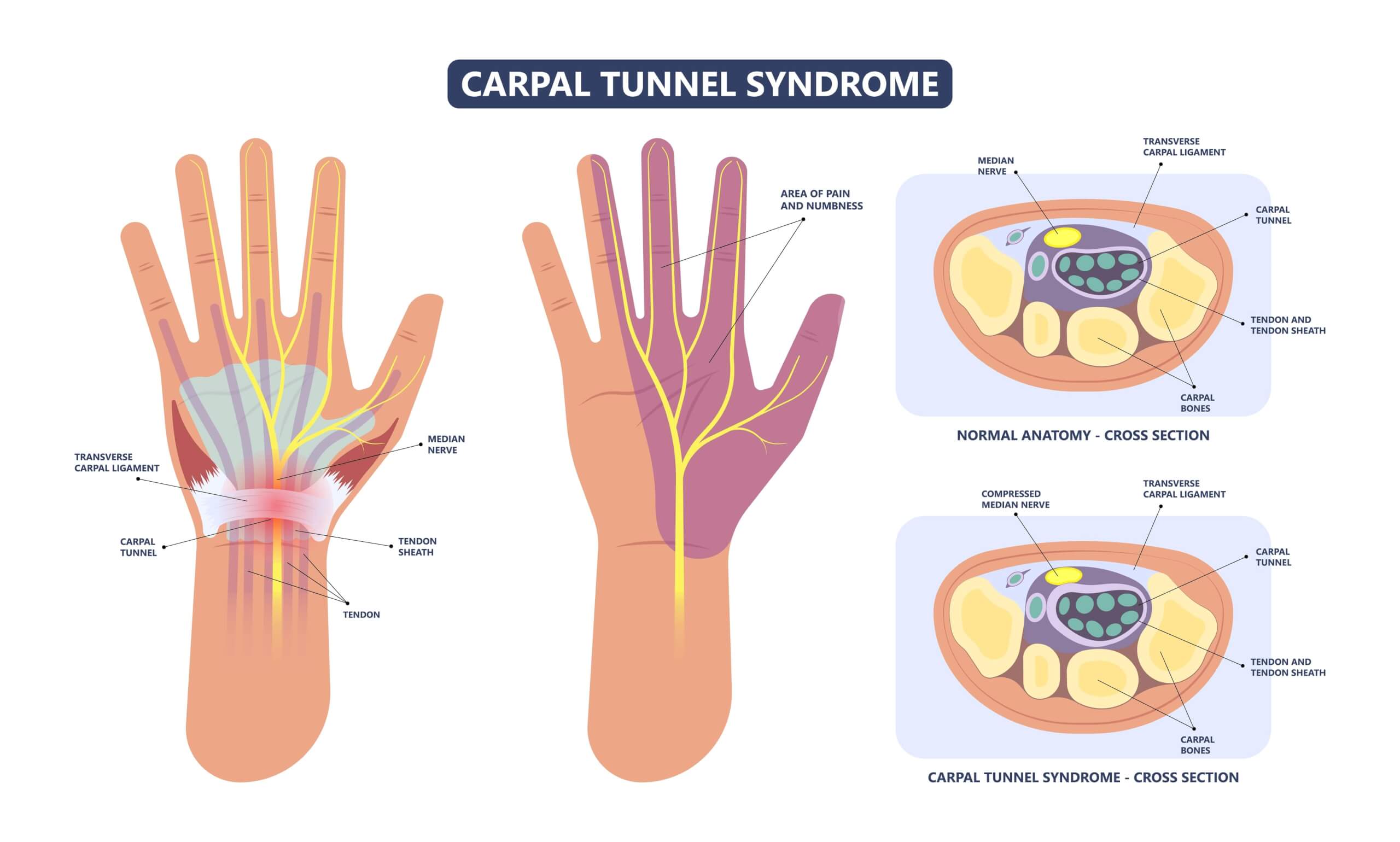 anatomy of the wrist