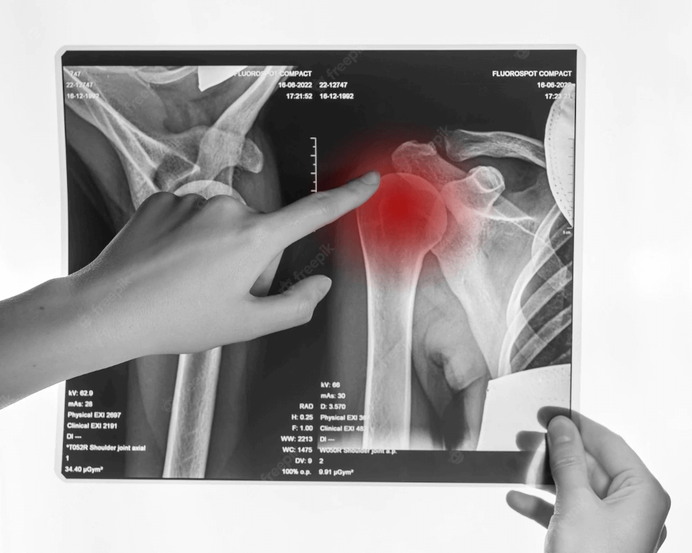 xray diagnostic screening