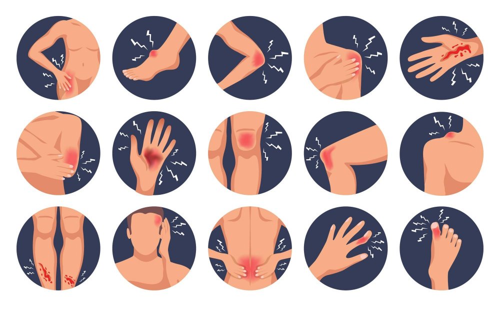 območja bolečine pri fibromialgiji