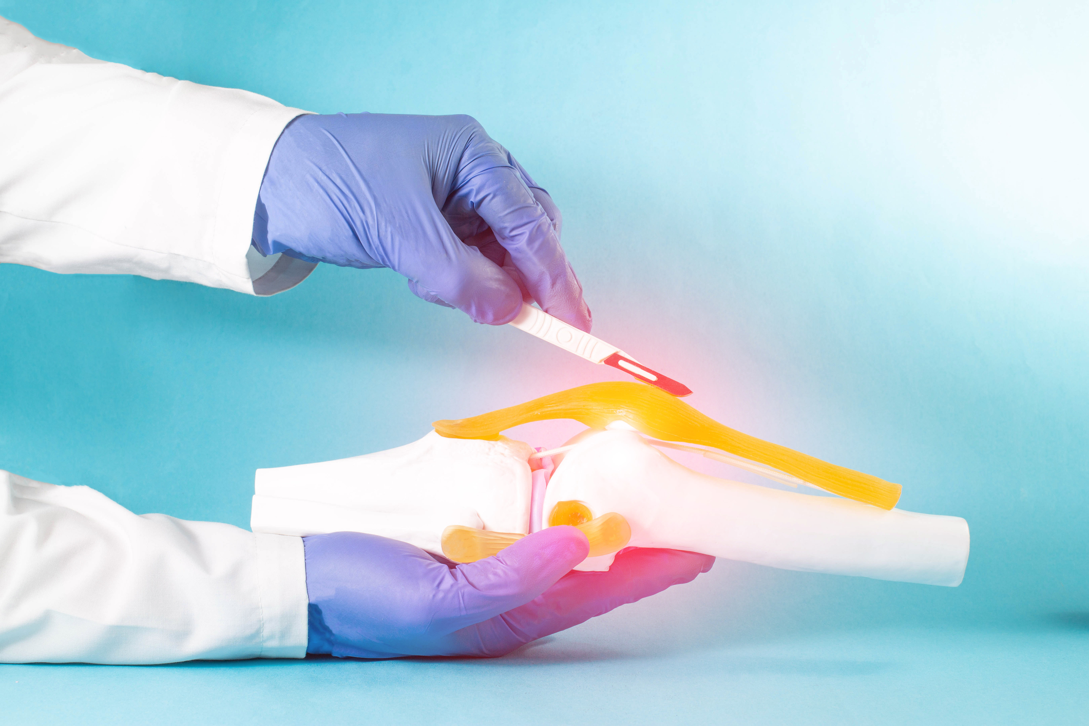 operacija kolena artroskopija