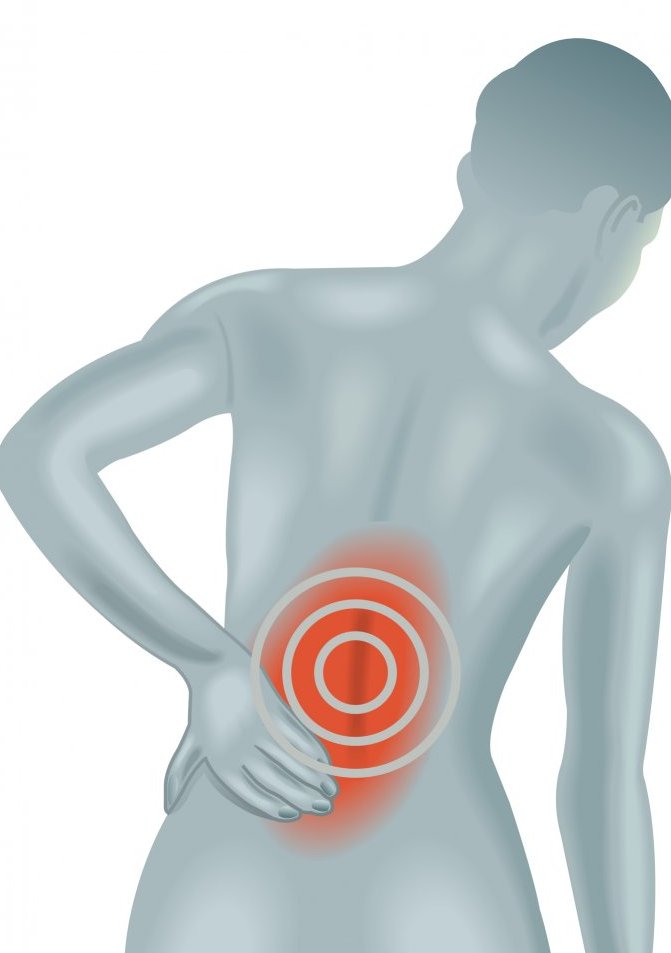 Akutna bolečina v križu