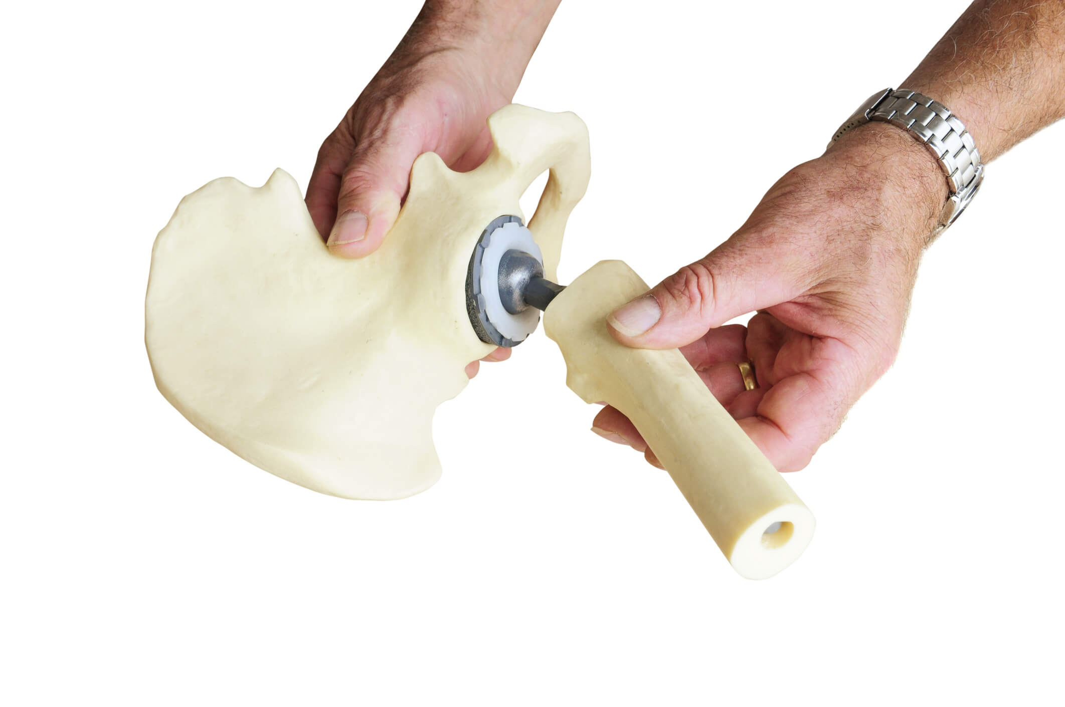 Rehabilitacija po operaciji kolka z endoprotezo