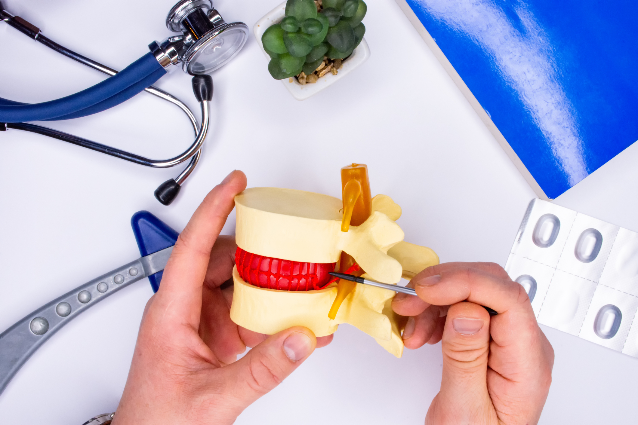 degenerativne spremembe hrustanca