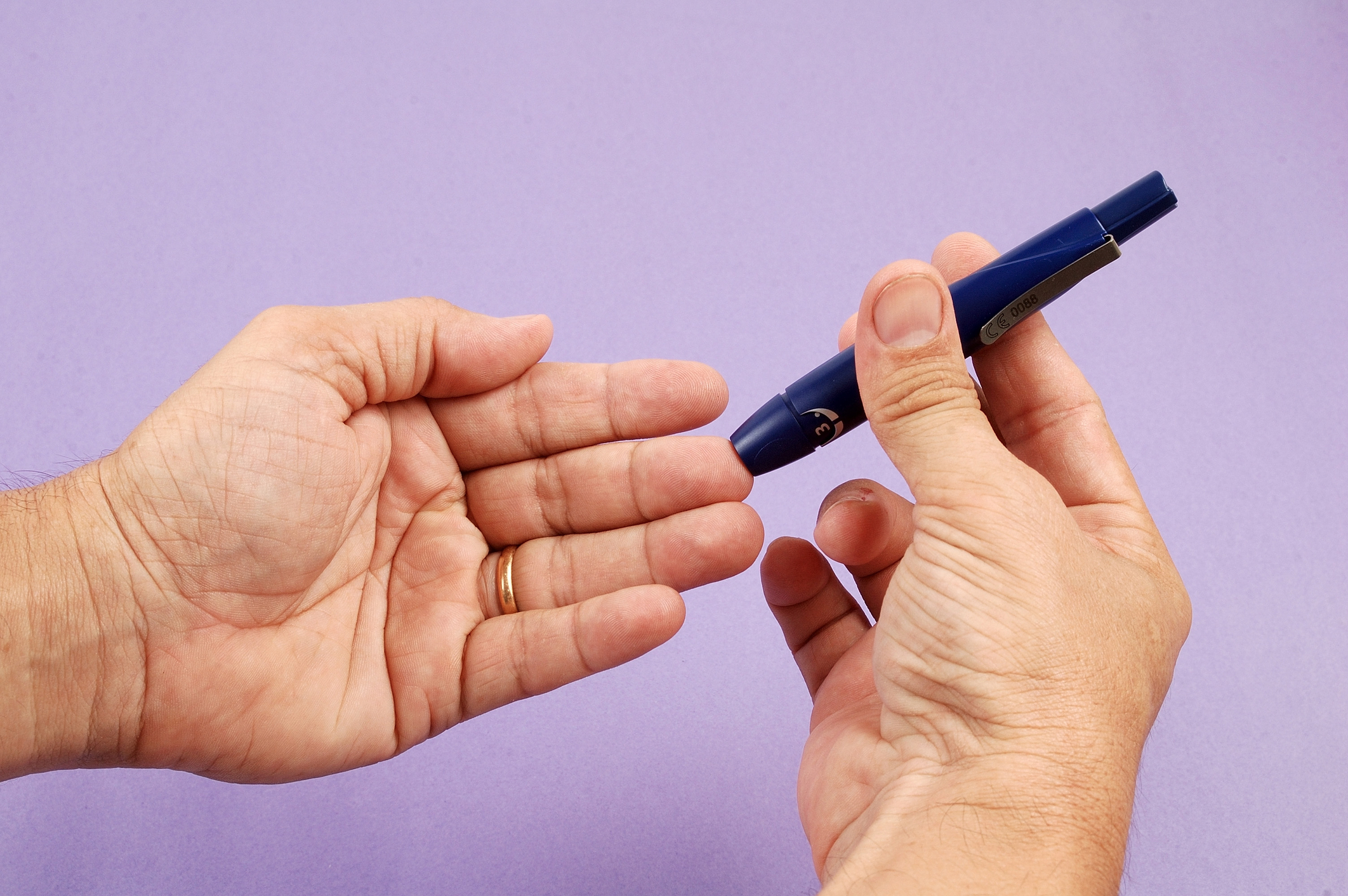 artroza prstov rizartroza