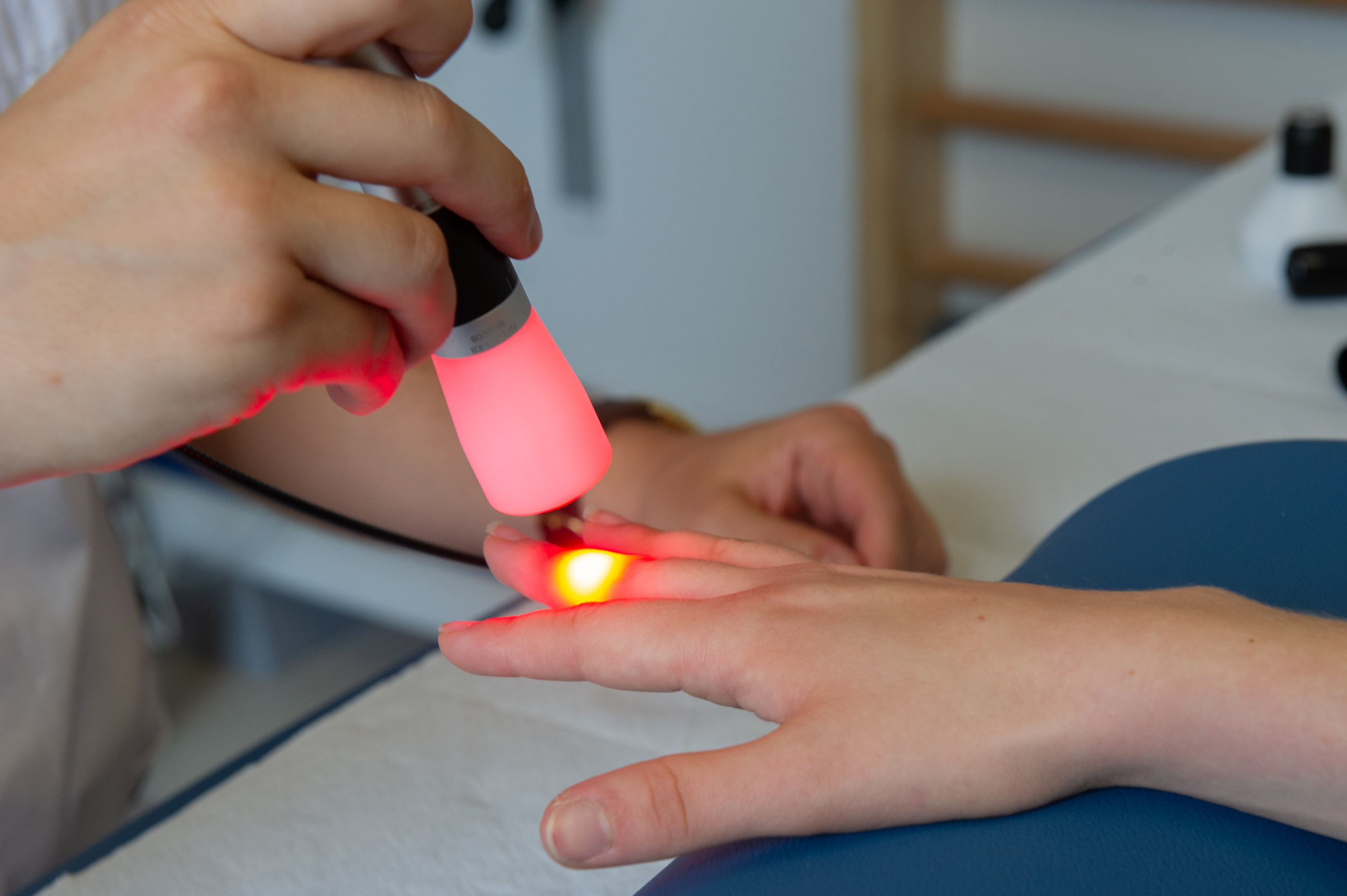 Fizioterapija vaje trigger finger