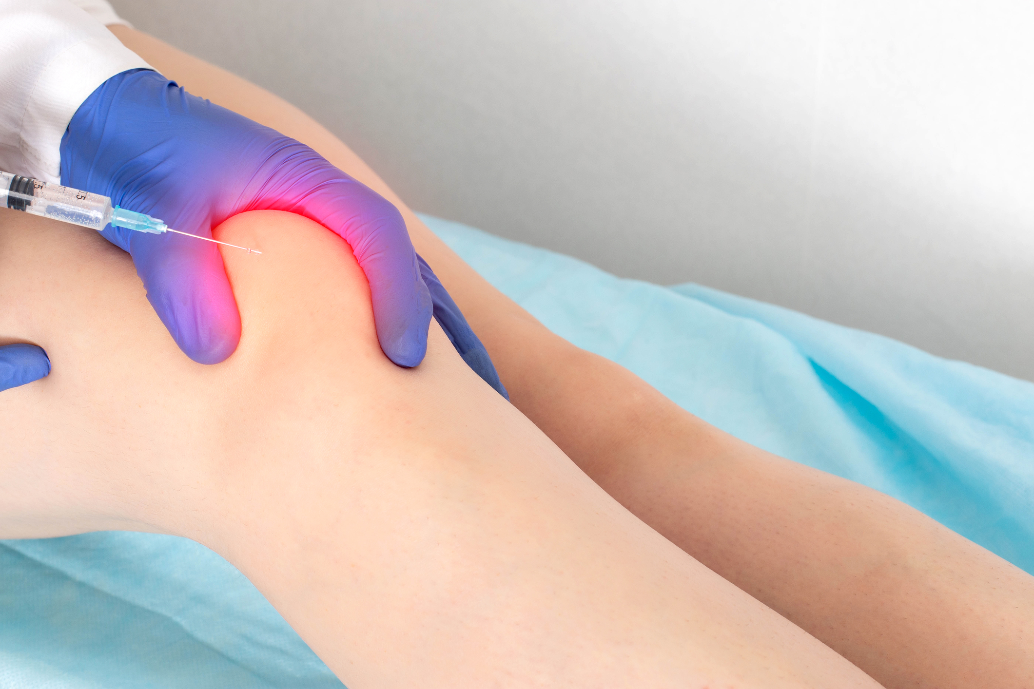 punkcija kolena okrevanje in rehabilitacija