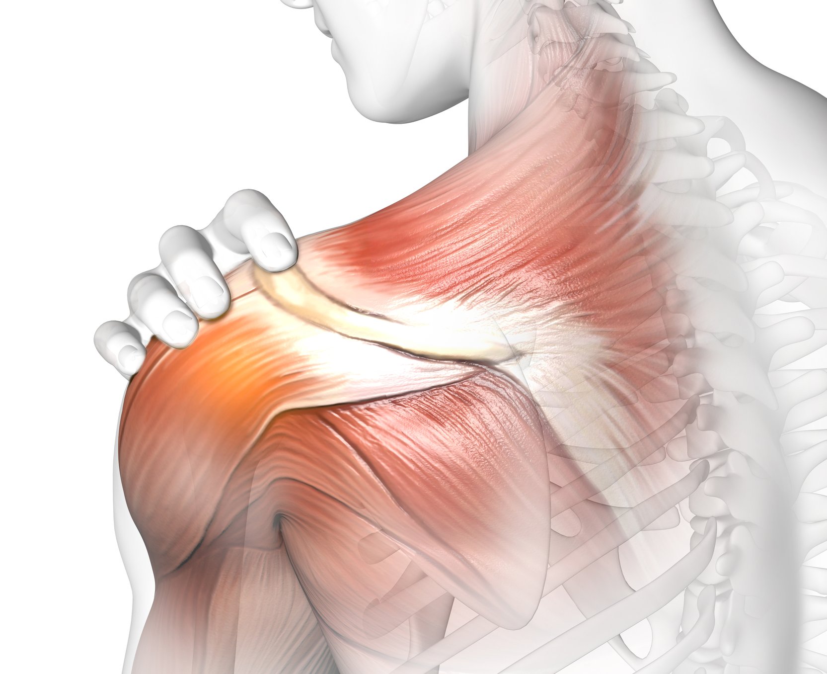 bolečina v rami subakromialni burzitis