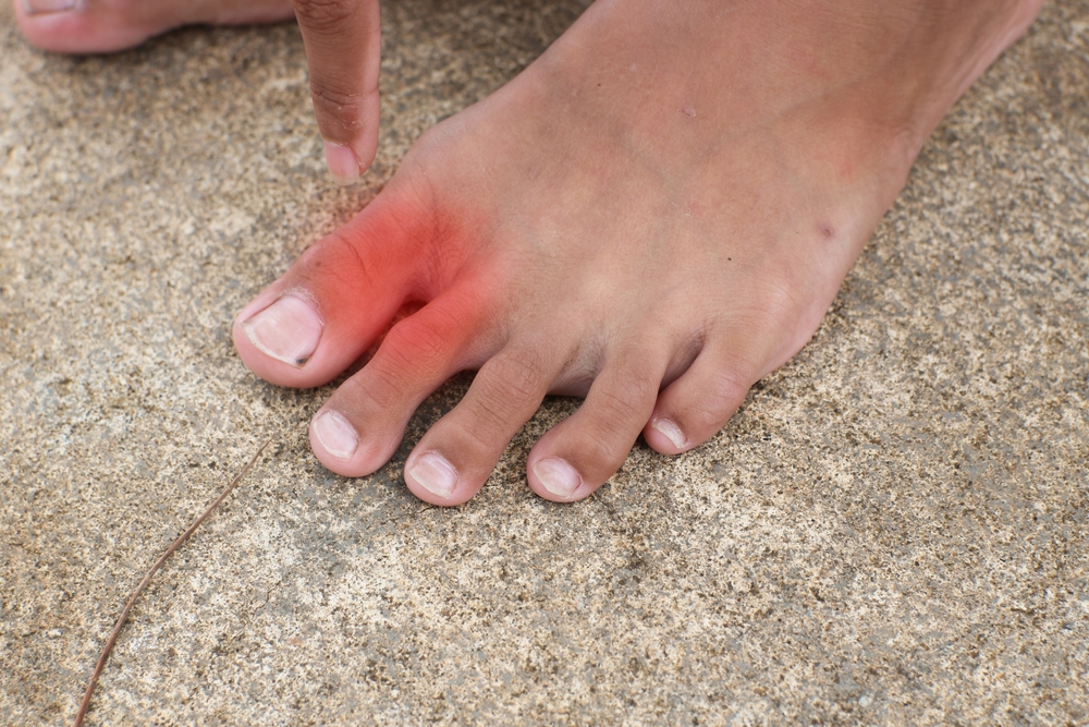Zlomljen prst na nogi: simptomi in zdravljenje