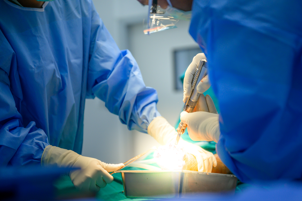 Operacija hallux valgus