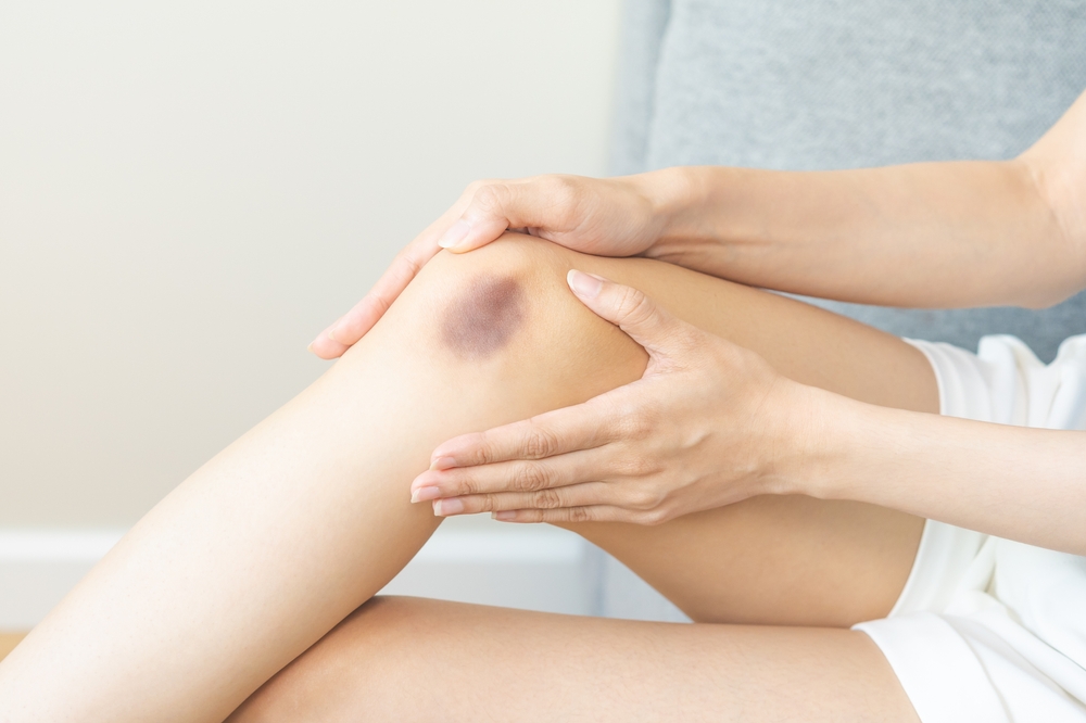 Močan udarec v kost simptomi